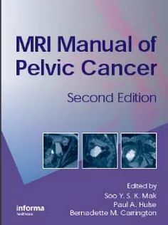 MRI Manual of Pelvic Cancer