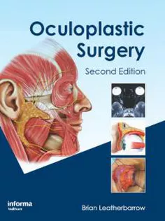 Oculoplastic Surgery
