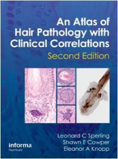 An Atlas of Hair Pathology with Clinical Correlations