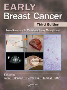 Early Breast Cancer