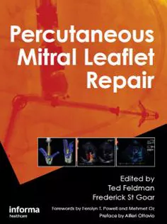 Percutaneous Mitral Leaflet Repair: MitraClip Therapy for Mitral Regurgitation