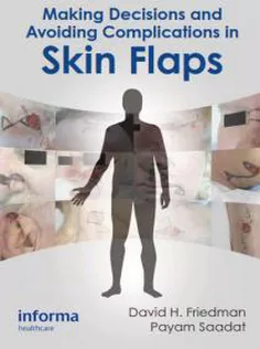 Making Decisions and Avoiding Complications in Skin Flaps