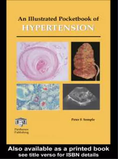 An Illustrated Pocketbook of Hypertension