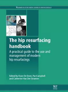 The Hip Resurfacing Handbook