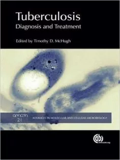 Tuberculosis