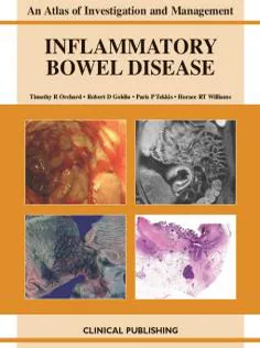 Inflammatory Bowel Disease
