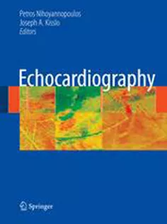 Echocardiography
