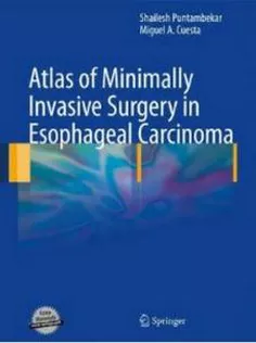 Atlas of Minimally Invasive Surgery in Esophageal Carcinoma