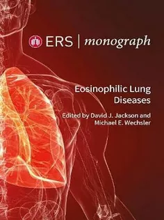 Eosinophilic Lung Diseases: 94 (ERS Monograph)