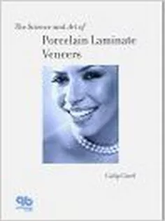 The Science and Art of Porcelain Laminate Veneers