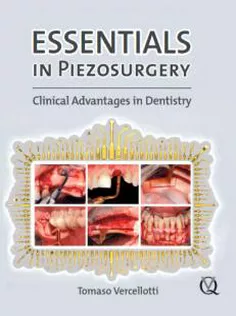 Essentials in Piezosurgery: Clinical Advantages in Dentistry