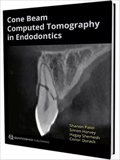 Cone Beam Computed Tomography in Endodontics