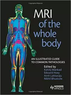 MRI of the Whole Body: An Illustrated Guide for Common Pathologies