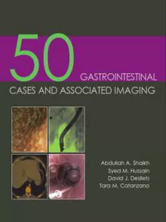 50 Gastrointestinal Cases and Associated Imaging