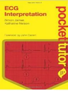 ECG Interpretation Pocket Tutor