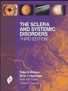 The Sclera and Systemic Disorders