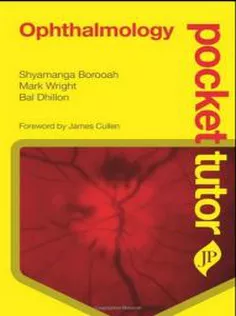 Ophthalmology Pocket Tutor