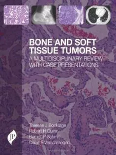 Bone and Soft Tissue Tumours