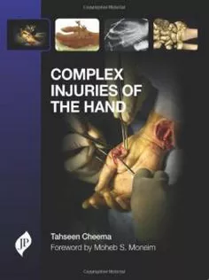 9781907816253 Complex Injuries of the Hand