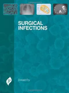 Surgical Infections