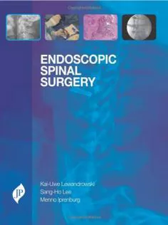 Endoscopic Spinal Surgery