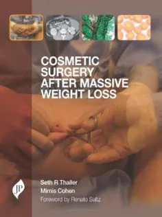 Cosmetic Surgery After Massive Weight Loss