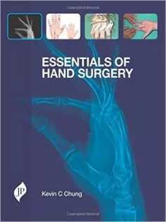 Essentials of Hand Surgery
