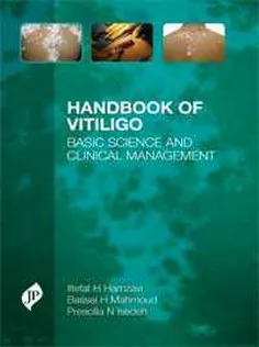 Handbook of Vitiligo