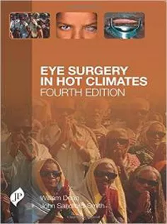 Eye Surgery in Hot Climates