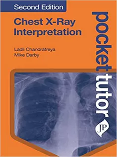 Pocket Tutor Chest X-Ray Interpretation