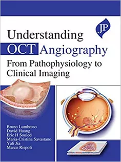 Understanding OCT Angiography from Pathophysiology to Clinical Imaging