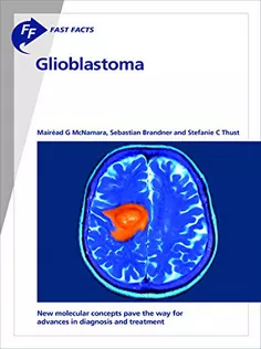 Fast Facts: Glioblastoma
