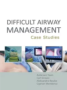 Difficult Airway Management