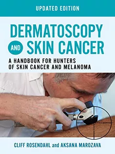 Dermatoscopy and Skin Cancer, Updated