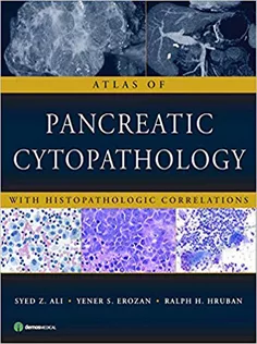 Atlas of Pancreatic Cytopathology with Histopathologic Correlations