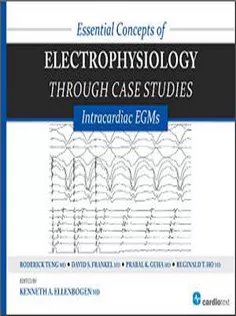 Essential Concepts of Electrophysiology Through Case Studies: Intracardiac EGMs