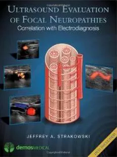 Ultrasound Evaluation of Focal Neuropathies
