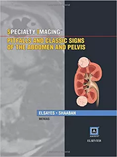9781937242183 Specialty Imaging: Pitfalls and Classic Signs of the Abdomen and Pelvis