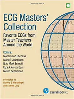 ECG Masters Collection: Favorite ECGs from Master Teachers Around the World