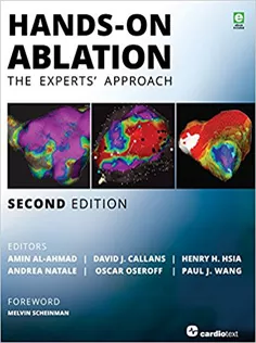 Hands-On Ablation: The Experts' Approach
