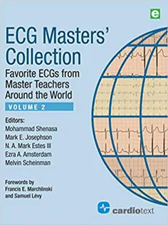 ECG Masters' Collection, Volume 2: Favorite ECGs from Master Teachers Around the World
