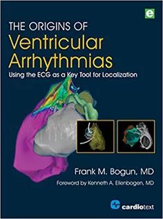 The Origins of Ventricular Arrhythmias: Using the ECG As A Key Tool for Localization