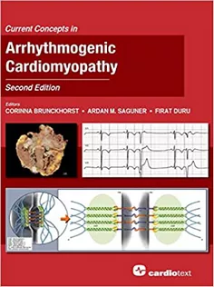 Current Concepts in Arrhythmogenic Cardiomyopathy