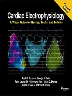 Cardiac Electrophysiology: A Visual Guide for Nurses, Techs, and Fellows