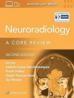 Neuroradiology: A Core Revie