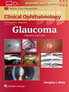 Glaucoma: Color Atlas & Synopsis of Clinical Ophthalmology