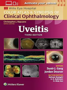 Color Atlas & Synopsis of Clinical Ophthalmology Uveitis