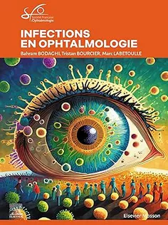 Infections En Ophtalmologie: Rapport SFO 2024