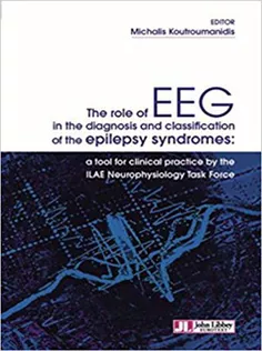 The Role of EEG in the Diagnosis and Classification of the Epilepsy Syndromes