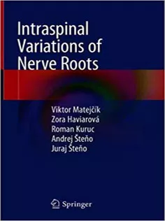 Intraspinal Variations of Nerve Roots